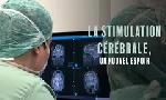 Revoir Soigner parkinson, l'�pilepsie, la d�pression : la stimulation c�r�brale, un nouvel espoir du 24 Janvier